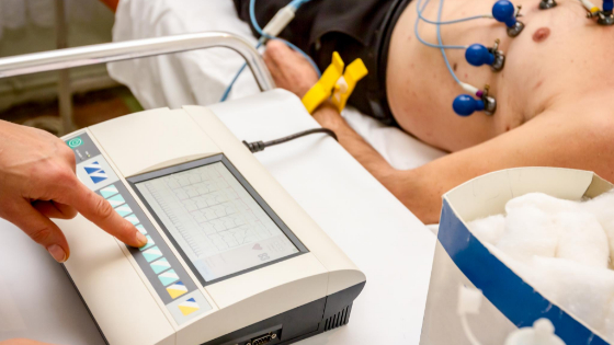 ecg procedure